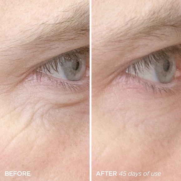 BEAUTY BIO R45 THE REVERSAL ANTI AGING RETINAL NIGHT CREAM AMAZING!!!!! - Picture 6 of 13